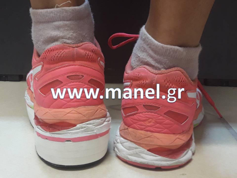 Εξωτερική ανύψωση για ανισοσκελία σε υποδήματα - παπούτσια