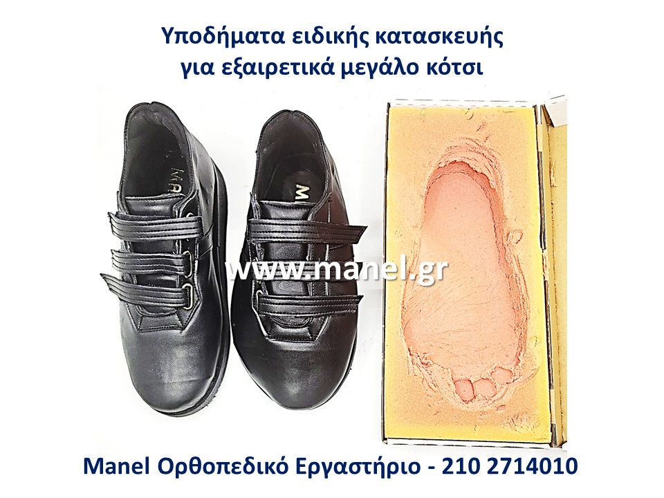 Ορθοπεδικά υποδήματα - παπούτσια για κότσι