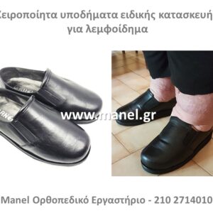 Παπούτσια για λεμφοίδημα